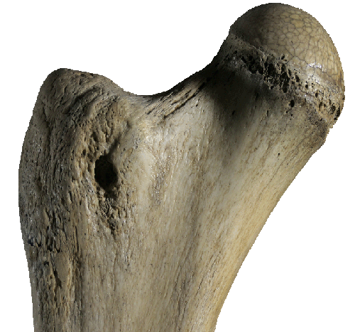 bone
          head